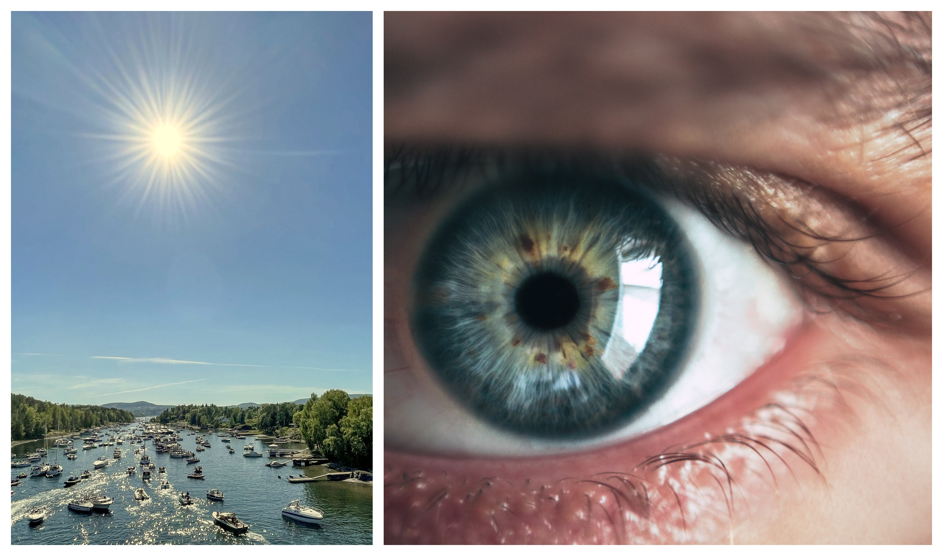 Hur skadliga är egentligen solens strålar för våra ögon?